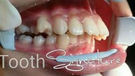 Apa Perbedaan Dokter Gigi Umum dan Dokter Gigi Spesialis Ortodonti